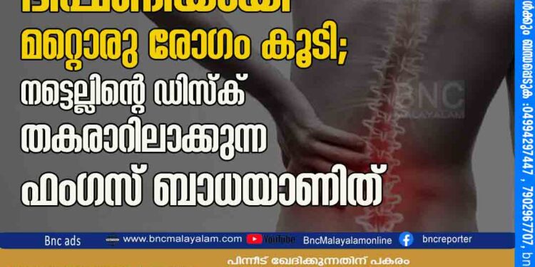 കോവിഡ് മുക്തര്‍ക്ക് ഭീഷണിയായി മറ്റൊരു രോഗം കൂടി; നട്ടെല്ലിന്റെ ഡിസ്‌ക് തകരാറിലാക്കുന്ന ഫംഗസ് ബാധയാണിത്