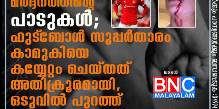 ചോരയൊലിക്കുന്ന മുഖം, ശരീരം നിറയെ മർദ്ദനത്തിന്റെ പാടുകൾ; ഫുട്‌ബോൾ സൂപ്പർതാരം കാമുകിയെ കയ്യേറ്റം ചെയ്തത് അതിക്രൂരമായി, ഒടുവിൽ പുറത്ത്