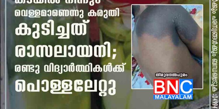 ഉപ്പിലിട്ടതു വിൽക്കുന്ന കടയിൽ നിന്നും വെള്ളമാണെന്നു കരുതി കുടിച്ചത് രാസലായനി; രണ്ടു വിദ്യാർത്ഥികൾക്ക് പൊള്ളലേറ്റു