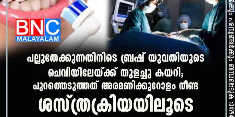 പല്ലുതേക്കുന്നതിനിടെ ബ്രഷ് യുവതിയുടെ ചെവിയിലേയ്ക്ക് തുളച്ചു കയറി; പുറത്തെടുത്തത് അരമണിക്കൂറോളം നീണ്ട ശസ്ത്രക്രിയയിലൂടെ