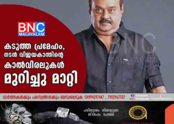 കടുത്ത പ്രമേഹം, നടൻ വിജയകാന്തിന്റെ കാൽവിരലുകൾ മുറിച്ചു മാറ്റി