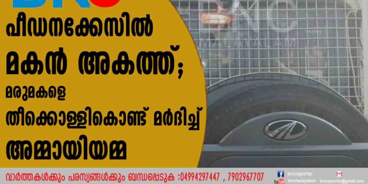 പീഡനക്കേസിൽ മകൻ അകത്ത്;   മരുമകളെ തീക്കൊള്ളികൊണ്ട് മർദിച്ച് അമ്മായിയമ്മ