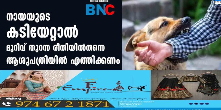 നായയുടെ കടിയേറ്റാൽ മുറിവ് തുറന്ന രീതിയിൽതന്നെ ആശുപത്രിയിൽ എത്തിക്കണം