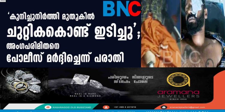 'കുനിച്ചുനിര്‍ത്തി മുതുകില്‍ ചുറ്റികകൊണ്ട് ഇടിച്ചു'; അംഗപരിമിതനെ പോലീസ് മര്‍ദ്ദിച്ചെന്ന് പരാതി