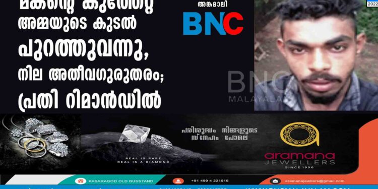 മകന്റെ കുത്തേറ്റ് അമ്മയുടെ കുടല്‍ പുറത്തുവന്നു, നില അതീവഗുരുതരം; പ്രതി റിമാന്‍ഡില്‍