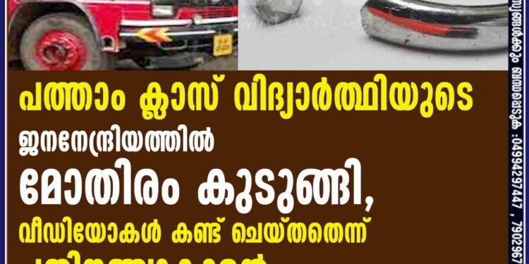 പത്താം ക്ലാസ് വിദ്യാർത്ഥിയുടെ ജനനേന്ദ്രിയത്തിൽ മോതിരം കുടുങ്ങി, വീഡിയോകൾ കണ്ട് ചെയ്തതെന്ന് പതിനഞ്ചുകാരൻ