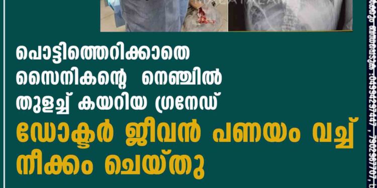 പൊട്ടിത്തെറിക്കാതെ സൈനികന്റെ നെഞ്ചിൽ തുളച്ച് കയറിയ ഗ്രനേഡ് ഡോക്ടർ ജീവൻ പണയം വച്ച് നീക്കം ചെയ്തു