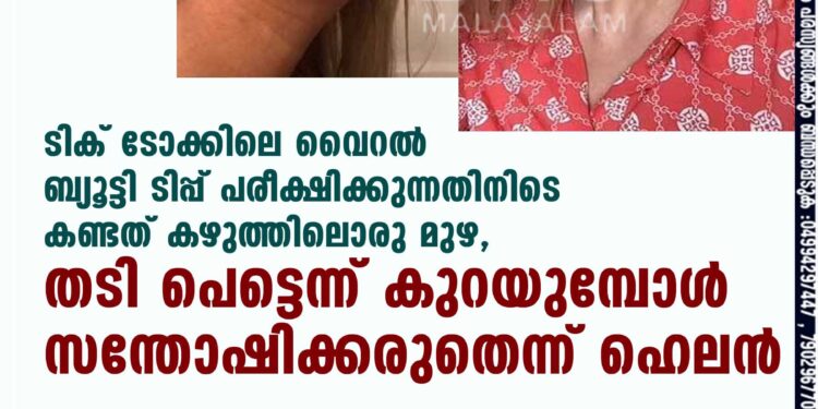 ടിക് ടോക്കിലെ വൈറൽ ബ്യൂട്ടി ടിപ്പ് പരീക്ഷിക്കുന്നതിനിടെ കണ്ടത് കഴുത്തിലൊരു മുഴ, തടി പെട്ടെന്ന് കുറയുമ്പോൾ സന്തോഷിക്കരുതെന്ന് ഹെലൻ v