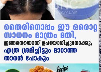 തൈരിനൊപ്പം ഈ ഒരൊറ്റ സാധനം മാത്രം മതി, ഇങ്ങനെയൊന്ന് ഉപയോഗിച്ചുനോക്കൂ; എത്ര ശ്രമിച്ചിട്ടും മാറാത്ത താരൻ പോകും