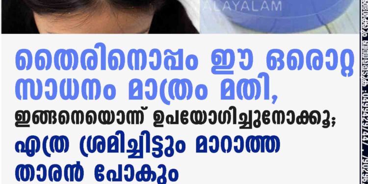 തൈരിനൊപ്പം ഈ ഒരൊറ്റ സാധനം മാത്രം മതി, ഇങ്ങനെയൊന്ന് ഉപയോഗിച്ചുനോക്കൂ; എത്ര ശ്രമിച്ചിട്ടും മാറാത്ത താരൻ പോകും