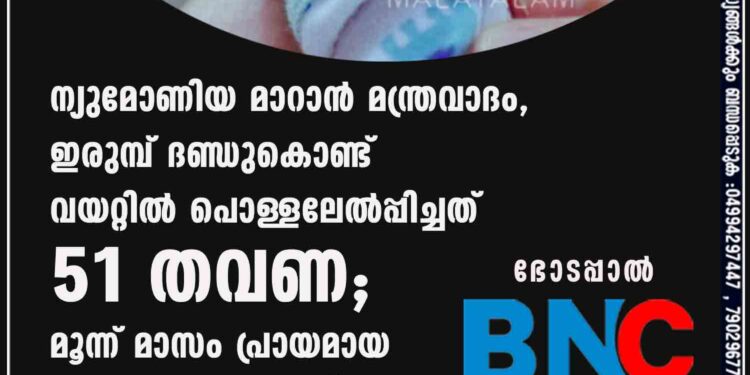 ന്യുമോണിയ മാറാൻ മന്ത്രവാദം, ഇരുമ്പ് ദണ്ഡുകൊണ്ട് വയറ്റിൽ പൊള്ളലേൽപ്പിച്ചത് 51 തവണ; മൂന്ന് മാസം പ്രായമായ കുഞ്ഞ് മരിച്ചു