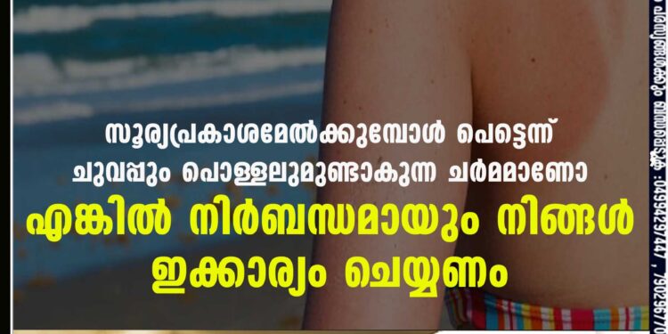 സൂര്യപ്രകാശമേൽക്കുമ്പോൾ പെട്ടെന്ന് ചുവപ്പും പൊള്ളലുമുണ്ടാകുന്ന ചർമമാണോ? എങ്കിൽ നിർബന്ധമായും നിങ്ങൾ ഇക്കാര്യം ചെയ്യണം