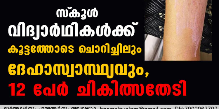 സ്‌കൂള്‍ വിദ്യാര്‍ഥികള്‍ക്ക് കൂട്ടത്തോടെ ചൊറിച്ചിലും ദേഹാസ്വാസ്ഥ്യവും, 12 പേര്‍ ചികിത്സതേടി