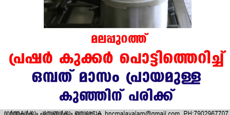 മലപ്പുറത്ത് പ്രഷര്‍ കുക്കര്‍ പൊട്ടിത്തെറിച്ച് ഒമ്പത് മാസം പ്രായമുള്ള കുഞ്ഞിന് പരിക്ക്